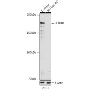 Western blot analysis of lysates from wild type (WT) and SETDB1 knockout (KO) 293T cells, using [KO Validated] SETDB1 Antibody at 1/1000 dilution. Secondary antibody: HRP-conjugated Goat anti-Rabbit IgG (H+L) at 1/10000 dilution. Lysates/proteins: 25 µg per lane. Blocking buffer: 3% nonfat dry milk in TBST. Exposure time: 30s.