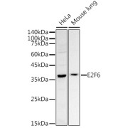 Western blot analysis of various lysates using E2F6 Antibody at 1/500 dilution. Secondary antibody: HRP-conjugated Goat anti-Rabbit IgG (H+L) at 1/10000 dilution. Lysates/proteins: 25 µg per lane. Blocking buffer: 3% nonfat dry milk in TBST. Exposure time: 180s.