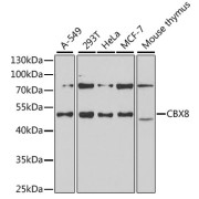 Western blot analysis of various lysates using CBX8 Antibody at 1/1000 dilution. Secondary antibody: HRP-conjugated Goat anti-Rabbit IgG (H+L) at 1/10000 dilution. Lysates/proteins: 25 µg per lane. Blocking buffer: 3% nonfat dry milk in TBST. Exposure time: 60s.