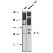 Western blot analysis of various lysates using CD5L Antibody at 1/1000 dilution. Secondary antibody: HRP-conjugated Goat anti-Rabbit IgG (H+L) at 1/10000 dilution. Lysates/proteins: 25 µg per lane. Blocking buffer: 3% nonfat dry milk in TBST. Detection: ECL Basic Kit (RM00020). Exposure time: 70s.