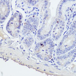 Gastric Inhibitory Polypeptide (GIP) Antibody