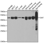 Western blot analysis of various lysates using OAT Antibody at 1/2000 dilution. Secondary antibody: HRP-conjugated Goat anti-Rabbit IgG (H+L) at 1/10000 dilution. Lysates/proteins: 25 µg per lane. Blocking buffer: 3% nonfat dry milk in TBST. Negative control (NC): RT4. Exposure time: 30s.