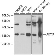 Western blot analysis of various lysates using AKTIP Antibody at 1/1000 dilution. Secondary antibody: HRP-conjugated Goat anti-Rabbit IgG (H+L) at 1/10000 dilution. Lysates/proteins: 25 µg per lane. Blocking buffer: 3% nonfat dry milk in TBST. Exposure time: 40s.