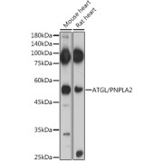 Western blot analysis of various lysates using ATGL/PNPLA2 Antibody at 1/500 dilution. Secondary antibody: HRP-conjugated Goat anti-Rabbit IgG (H+L) at 1/10000 dilution. Lysates / proteins: 25 µg per lane. Blocking buffer: 3 % nonfat dry milk in TBST. Detection: ECL Basic Kit (RM00020). Exposure time: 60s.