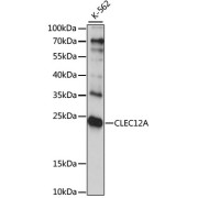 Western blot analysis of lysates from K-562 cells, using CLEC12A Antibody at 1/1000 dilution. Secondary antibody: HRP-conjugated Goat anti-Rabbit IgG (H+L) at 1/10000 dilution. Lysates/proteins: 25 µg per lane. Blocking buffer: 3% nonfat dry milk in TBST. Exposure time: 15s.