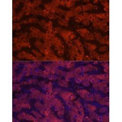 17-Beta-Hydroxysteroid Dehydrogenase 13 (HSD17B6) Antibody