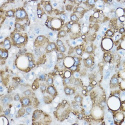 Perilipin-2 (PLIN2) Antibody