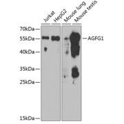 Western blot analysis of various lysates using AGFG1 Antibody at 1/1000 dilution. Secondary antibody: HRP-conjugated Goat anti-Rabbit IgG (H+L) at 1/10000 dilution. Lysates/proteins: 25 µg per lane. Blocking buffer: 3% nonfat dry milk in TBST. Exposure time: 90s.