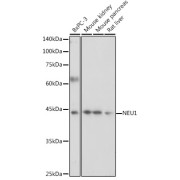 Western blot analysis of various lysates using NEU1 Antibody at 1/1000 dilution. Secondary antibody: HRP-conjugated Goat anti-Rabbit IgG (H+L) at 1/10000 dilution. Lysates/proteins: 25 µg per lane. Blocking buffer: 3% nonfat dry milk in TBST. Exposure time: 30s.