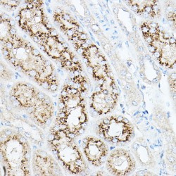 Sialidase-1 (NEU1) Antibody