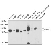 Western blot analysis of various lysates using NOL3 Antibody at 1/1000 dilution. Secondary antibody: HRP-conjugated Goat anti-Rabbit IgG (H+L) at 1/10000 dilution. Lysates/proteins: 25 µg per lane. Blocking buffer: 3% nonfat dry milk in TBST. Exposure time: 30s.