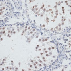 Nucleolar Protein 3 (NOL3) Antibody