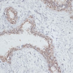 Nucleolar Protein 3 (NOL3) Antibody