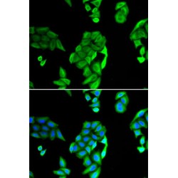 Nucleolar Protein 3 (NOL3) Antibody