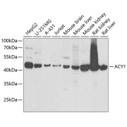 Western blot analysis of various lysates using ACY1 Antibody at 1/1000 dilution. Secondary antibody: HRP-conjugated Goat anti-Rabbit IgG (H+L) at 1/10000 dilution. Lysates/proteins: 25 µg per lane. Blocking buffer: 3% nonfat dry milk in TBST. Exposure time: 90s.