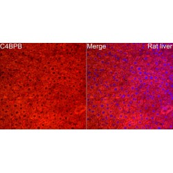 C4b-Binding Protein Beta Chain (C4BPB) Antibody