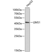 Western blot analysis of lysates from HepG2 cells, using LIMS1 Antibody at 1/1000 dilution. Secondary antibody: HRP-conjugated Goat anti-Rabbit IgG (H+L) at 1/10000 dilution. Lysates/proteins: 25 µg per lane. Blocking buffer: 3% nonfat dry milk in TBST. Exposure time: 90s.