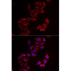 LIM Zinc Finger Domain Containing 1 (LIMS1) Antibody