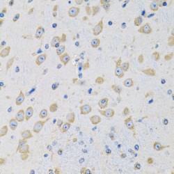 Mitochondrial Peptide Methionine Sulfoxide Reductase (MSRA) Antibody