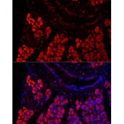 Pancreatic Triacylglycerol Lipase (PNLIP) Antibody