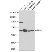 Western blot analysis of various lysates using PPOX Antibody at 1/1000 dilution. Secondary antibody: HRP-conjugated Goat anti-Rabbit IgG (H+L) at 1/10000 dilution. Lysates/proteins: 25 µg per lane. Blocking buffer: 3% nonfat dry milk in TBST. Exposure time: 90s.