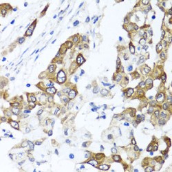 Protoporphyrinogen Oxidase (PPOX) Antibody