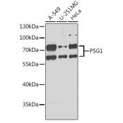 Western blot analysis of various lysates using PSG1 Antibody at 1/1000 dilution. Secondary antibody: HRP-conjugated Goat anti-Rabbit IgG (H+L) at 1/10000 dilution. Lysates/proteins: 25 µg per lane. Blocking buffer: 3% nonfat dry milk in TBST. Exposure time: 90s.