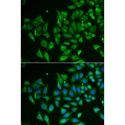 Immunofluorescence analysis of HeLa cells using CLEC3B/Tetranectin Antibody. Secondary antibody: Cy3-conjugated Goat anti-Rabbit IgG (H+L) at 1/500 dilution. Blue: DAPI for nuclear staining.