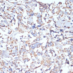 Cytochrome C Oxidase Subunit 5A (COX5A) Antibody