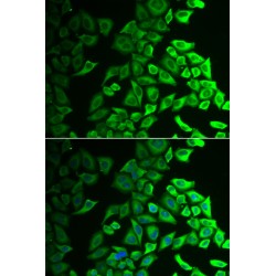 Interleukin 18 Binding Protein (IL18BP) Antibody