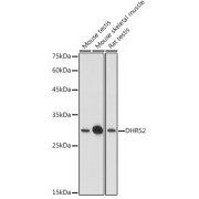 Western blot analysis of various lysates using DHRS2 Antibody at 1/1000 dilution. Secondary antibody: HRP-conjugated Goat anti-Rabbit IgG (H+L) at 1/10000 dilution. Lysates/proteins: 25 µg per lane. Blocking buffer: 3% nonfat dry milk in TBST. Exposure time: 5s.