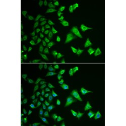 Dehydrogenase/Reductase SDR Family Member 2 (DHRS2) Antibody