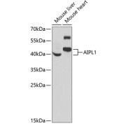 Western blot analysis of various lysates using AIPL1 Antibody at 1/1000 dilution. Secondary antibody: HRP-conjugated Goat anti-Rabbit IgG (H+L) at 1/10000 dilution. Lysates/proteins: 25 µg per lane. Blocking buffer: 3% nonfat dry milk in TBST. Exposure time: 90s.