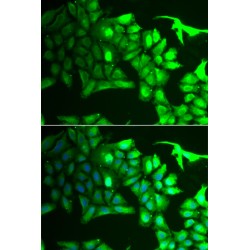 Aryl Hydrocarbon Interacting Protein Like 1 (AIPL1) Antibody