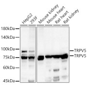 Western blot analysis of various lysates, using TRPV5 Antibody at 1/500 dilution. Secondary antibody: HRP-conjugated Goat anti-Rabbit IgG (H+L) at 1/10000 dilution. Lysates/proteins: 25 µg per lane. Blocking buffer: 3% nonfat dry milk in TBST. Exposure time: 60s.