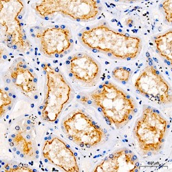 Transient Receptor Potential Cation Channel Subfamily V Member 5 (TRPV5) Antibody