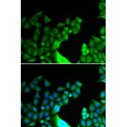 Bcl2 Like Protein 14 (BCL2L14) Antibody