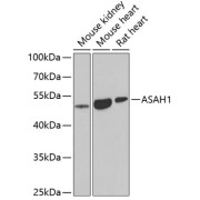 Western blot analysis of various lysates using ASAH1 Antibody at 1/1000 dilution. Secondary antibody: HRP-conjugated Goat anti-Rabbit IgG (H+L) at 1/10000 dilution. Lysates/proteins: 25 µg per lane. Blocking buffer: 3% nonfat dry milk in TBST. Exposure time: 90s.