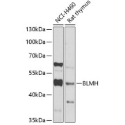 Western blot analysis of various lysates using BLMH Antibody at 1/1000 dilution. Secondary antibody: HRP-conjugated Goat anti-Rabbit IgG (H+L) at 1/10000 dilution. Lysates/proteins: 25 µg per lane. Blocking buffer: 3% nonfat dry milk in TBST. Exposure time: 30s.