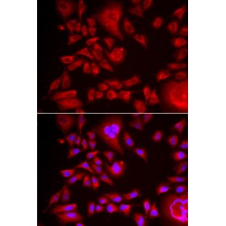 Bleomycin Hydrolase (BLMH) Antibody