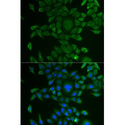 Cysteine-S-Conjugate Beta-Lyase (CCBL1) Antibody