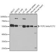 Western blot analysis of various lysates using TCP1 beta/CCT2 Antibody at 1/1000 dilution. Secondary antibody: HRP-conjugated Goat anti-Rabbit IgG (H+L) at 1/10000 dilution. Lysates/proteins: 25 µg per lane. Blocking buffer: 3% nonfat dry milk in TBST. Exposure time: 15s.