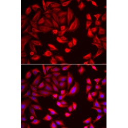 T-Complex Protein 1 Subunit Beta (CCT2) Antibody