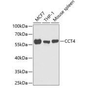 Western blot analysis of various lysates using CCT4 Antibody at 1/1000 dilution. Secondary antibody: HRP-conjugated Goat anti-Rabbit IgG (H+L) at 1/10000 dilution. Lysates/proteins: 25 µg per lane. Blocking buffer: 3% nonfat dry milk in TBST. Exposure time: 90s.