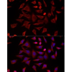 T-Complex Protein 1 Subunit Delta (CCT4) Antibody