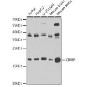 Western blot analysis of various lysates using [KO Validated] CIRBP Antibody at 1/1000 dilution. Secondary antibody: HRP-conjugated Goat anti-Rabbit IgG (H+L) at 1/10000 dilution. Lysates/proteins: 25 µg per lane. Blocking buffer: 3% nonfat dry milk in TBST. Exposure time: 90s.