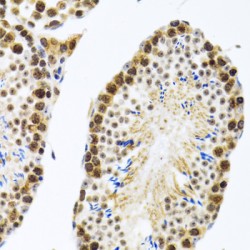 Cold-Inducible RNA-Binding Protein (CIRBP) Antibody