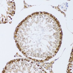 Cold-Inducible RNA-Binding Protein (CIRBP) Antibody