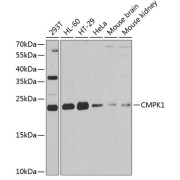 Western blot analysis of various lysates using CMPK1 Antibody at 1/1000 dilution. Secondary antibody: HRP-conjugated Goat anti-Rabbit IgG (H+L) at 1/10000 dilution. Lysates/proteins: 25 µg per lane. Blocking buffer: 3% nonfat dry milk in TBST. Exposure time: 90s.