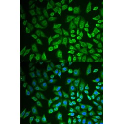 Probable ATP-Dependent RNA Helicase DDX41 (DDX41) Antibody